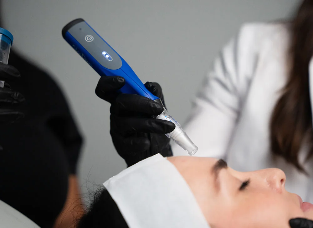 Close up shot of a doctor and nurse work together on a client lying on an exam table, wearing a white headband with her eyes closed. The nurse uses a laser on her face while the doctor holds her face steady. The doctor is wearing a white lab coat, and the nurse is in black scrubs, both wearing black latex gloves. - CO2 Laser Resurfacing in Aventura, FL