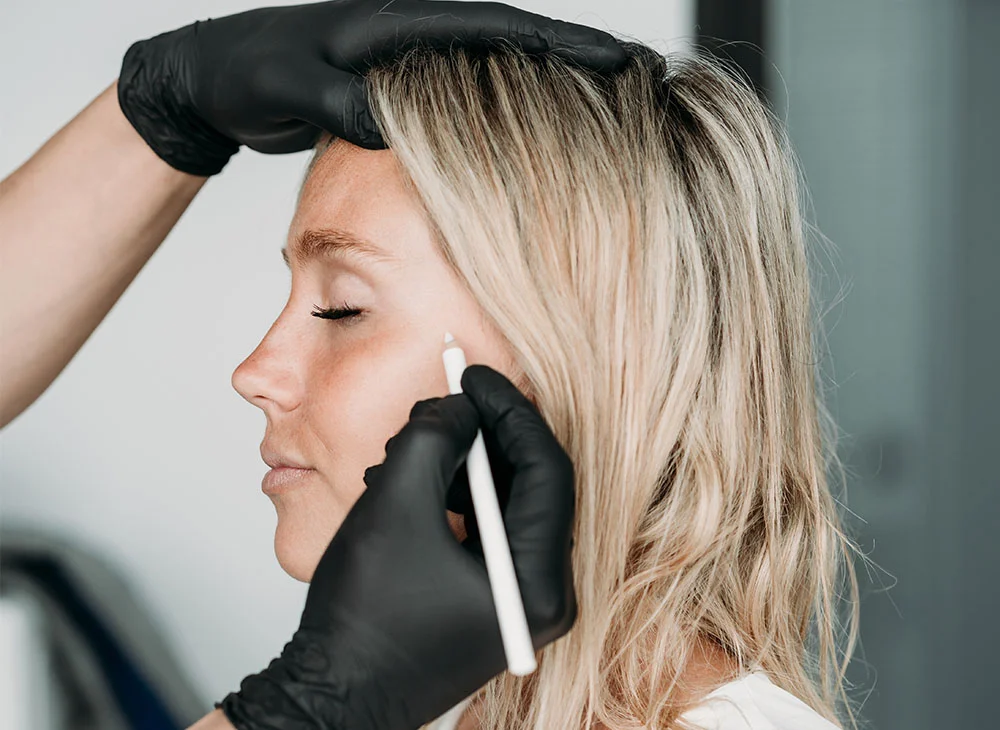 Young woman with blonde hair and her eyes closed as a doctor marks her cheek. The doctor, wearing black latex gloves, is gently holding the top of her head with one hand while using the other hand to make the markings. - Temple Filler Fillers Rejuvenation in Aventura, FL